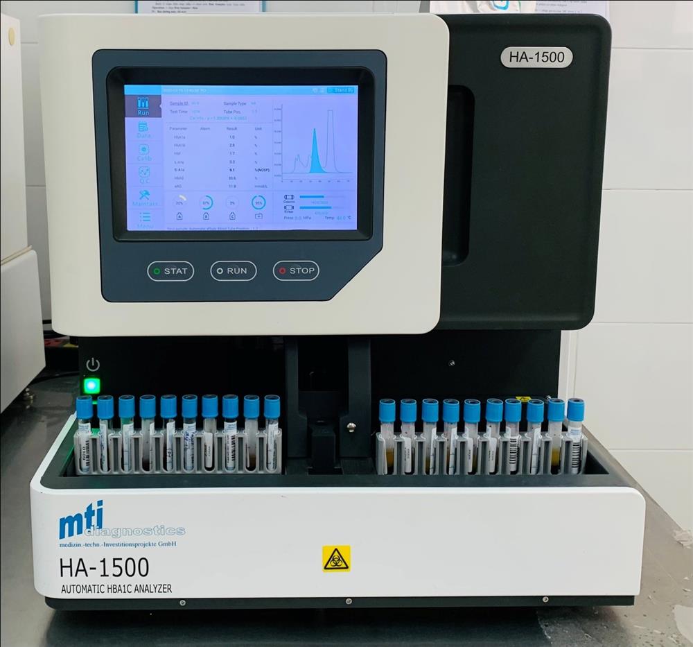 Giá trị của xét nghiệm Hba1c